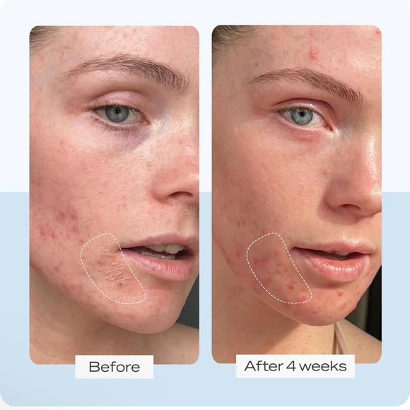 New First Aid Beauty ultra repair cream 6 oz & 1oz containers - Picture 5 of 7